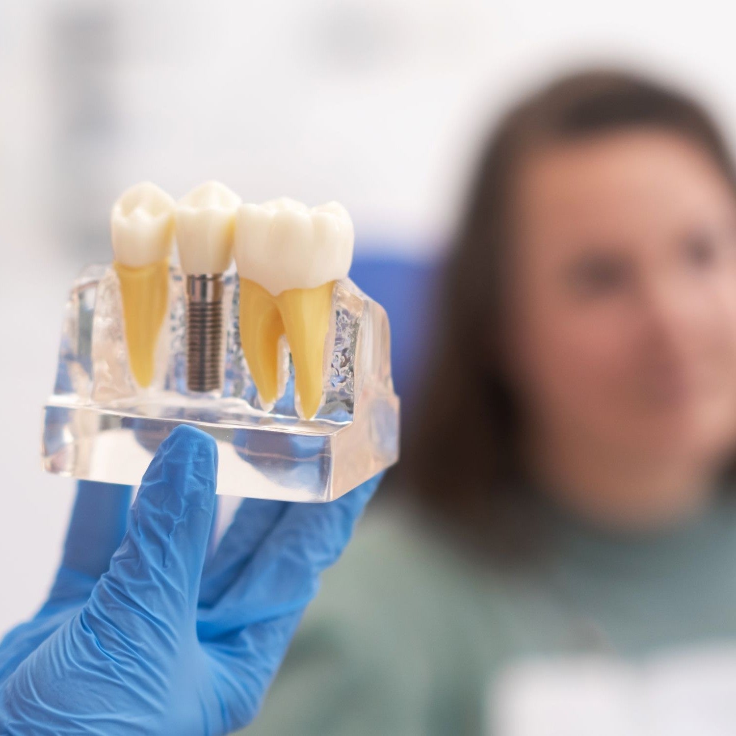 And the Answer is…It Depends! Answers to your questions about dental implant maintenance