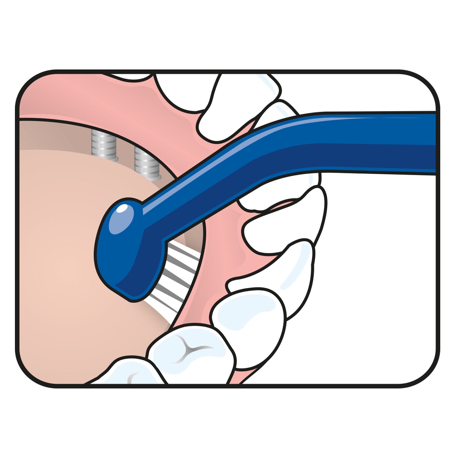 TePe Universal Care™
