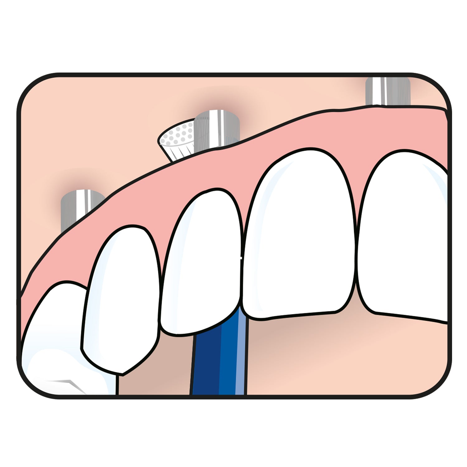 TePe Universal Care™